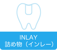 詰め物（インレー）